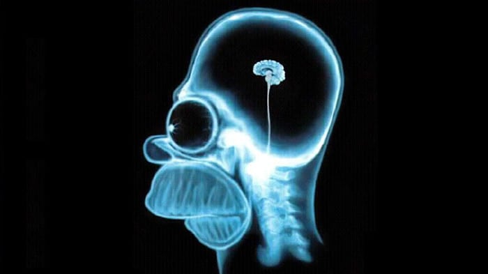Le cerveau d'Homer Simpson aux rayons X!