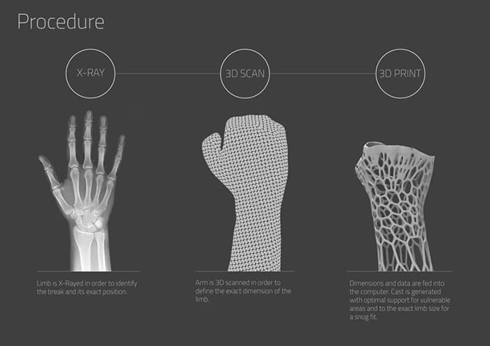 cortex-un-platre-revolutionnaire4